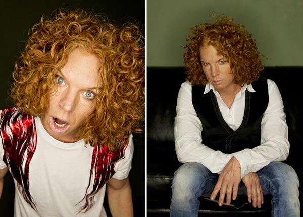 Carrot Top Plastic After Surgery Photo