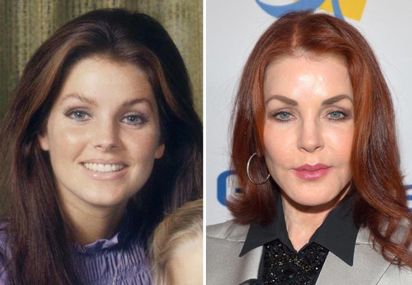 Priscilla Presley Plastic Surgery Before & After