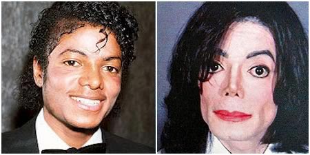 Michael Jackson Plastic Surgery Pictures