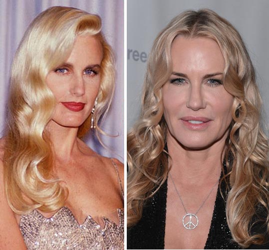Daryl Hannah Plastic Surgery Before & After