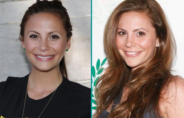 Gia Allemand Plastic Surgery