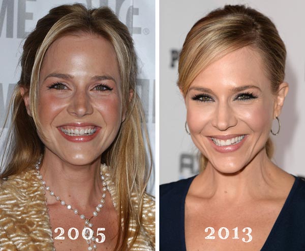 Julie Benz Plastic Surgery Before & After
