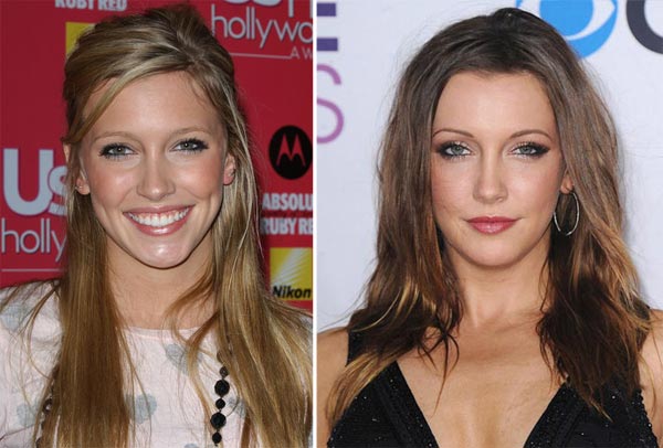Katie Cassidy Plastic Surgery Before And After