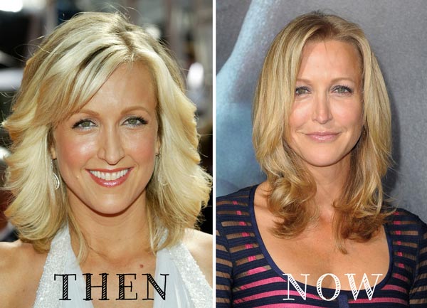 Lara Spencer Plastic Surgery Before & After
