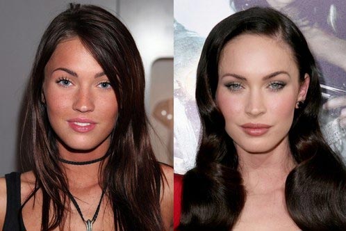 Megan Fox Nose Job Before & After