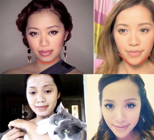 Michelle Phan Plastic Surgery Before & After