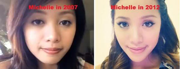 Michelle Phan Plastic Surgery