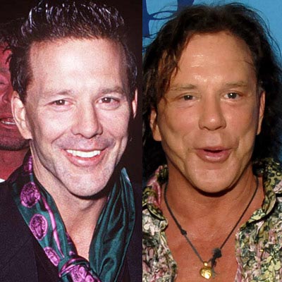 Mickey Rourke Plastic Surgery Disaster