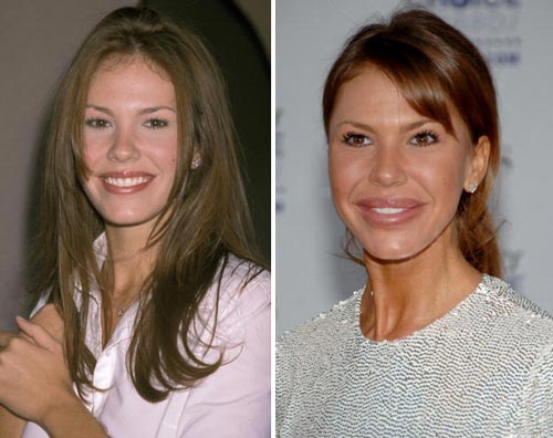 Nikki Cox Plastic Surgery Before & After