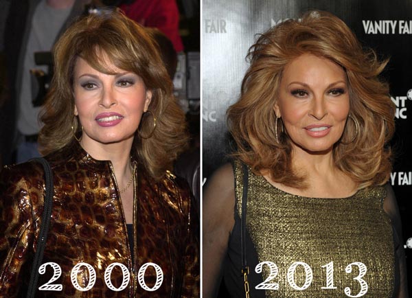 Raquel Welch Plastic Surgery Before & After