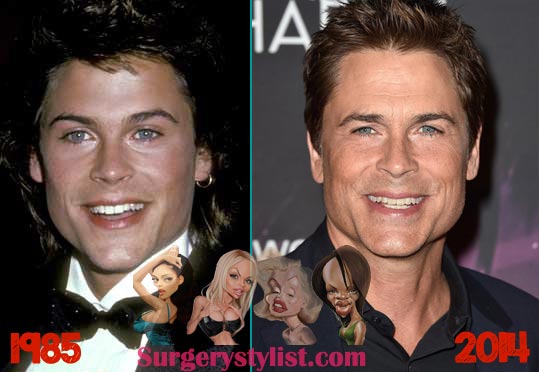 Rob Lowe Plastic Surgery Before & After
