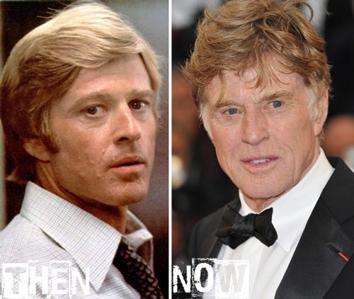 Robert Redford Plastic Surgery Before & After