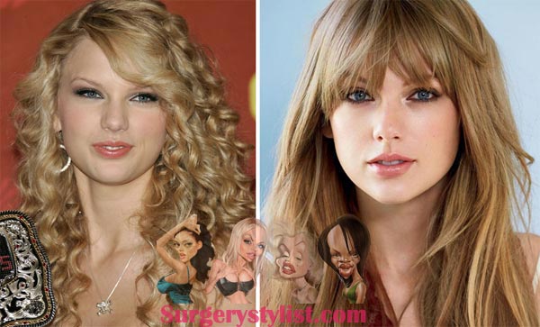 Taylor Swift Plastic Surgery