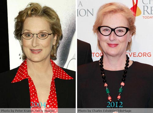 Meryl Streep Plastic Surgery Before & After
