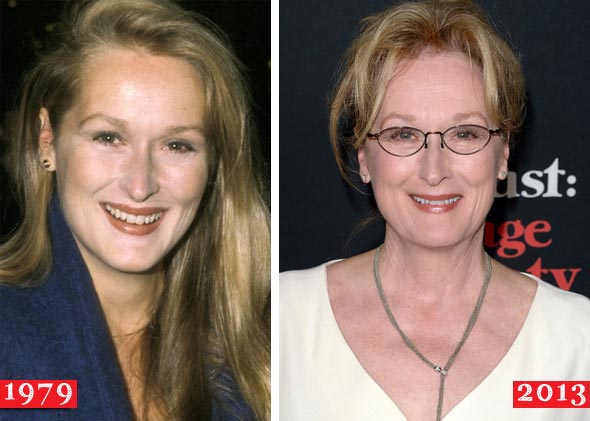 Meryl Streep Plastic Surgery