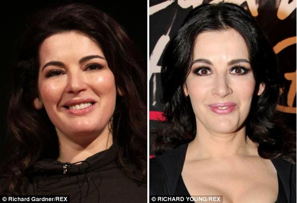 Nigella Lawson Plastic Surgery Before & After