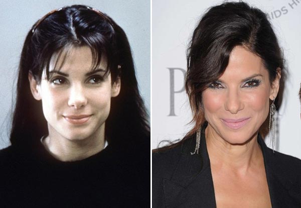 Sandra Bullock Plastic Surgery Before & After