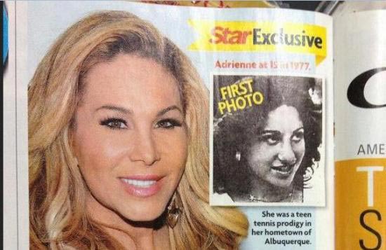 Adrienne Maloof Plastic Surgery Before & After