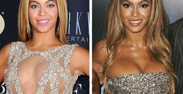 Beyonce Plastic Surgery Pictures