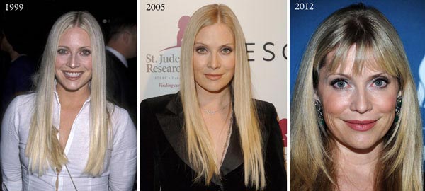 Emily Procter Plastic Surgery Before & After