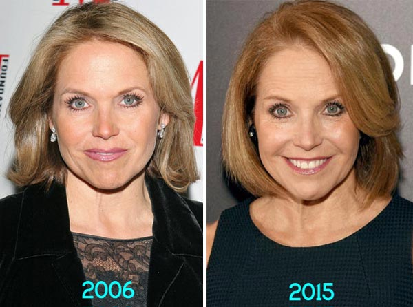 Katie Couric Plastic Surgery Before& After