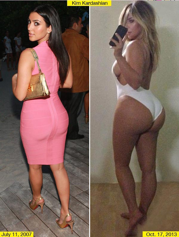 Kim Kardashian Butt Implants Before & After