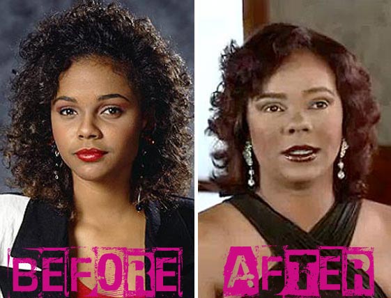 Lark Voorhies Plastic Surgery Before & After