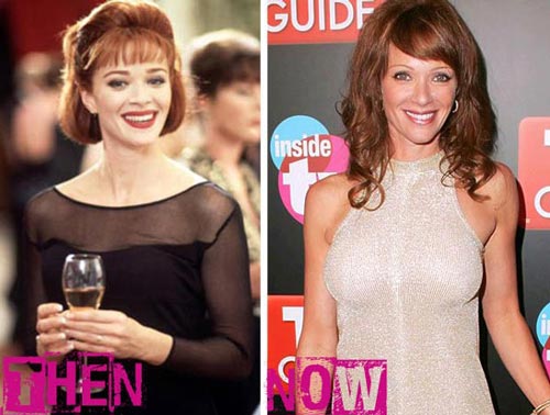 Lauren Holly Plastic Surgery Before After Picture