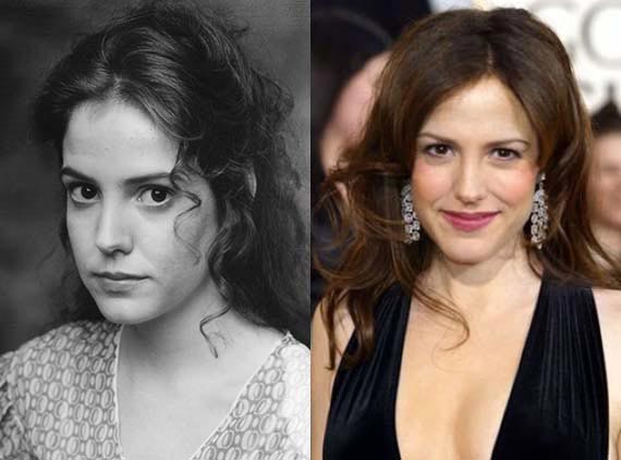 Mary Louise Parker Plastic Surgery Before & After