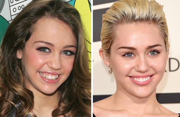 Miley Cyrus Plastic Surgery Before & After
