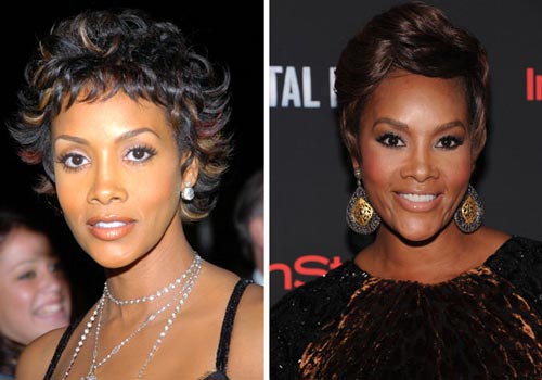 Vivica Fox Plastic Surgery Before & After