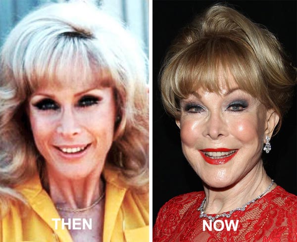 Barbara Eden Plastic Surgery Before & After