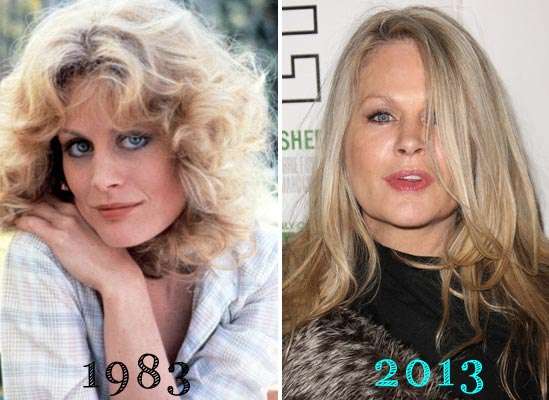 Beverly D Angelo Plastic Surgery
