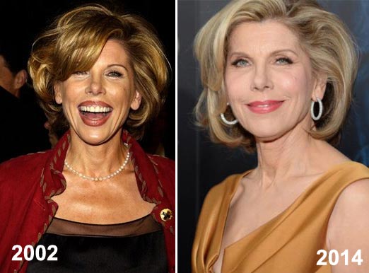 Christine Baranski Plastic Surgery Before & After