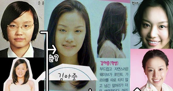 Kim Ah Joong Plastic Surgery Before & After
