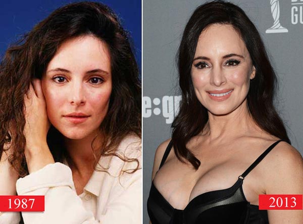 Madeleine Stowe Plastic Surgery Before & After