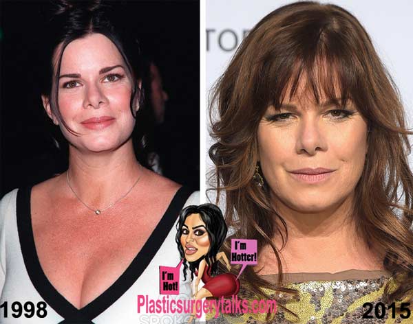 Marcia Gay Harden Plastic Surgery Before & After