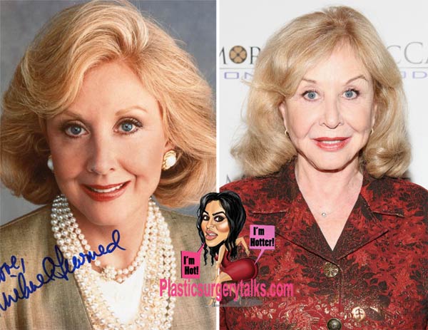Michael Learned Plastic Surgery Before & After