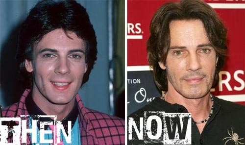 Rick Springfield Plastic Surgery Before & After