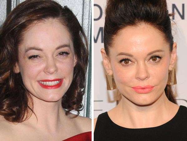 Rose McGowan Plastic Surgery Before & After