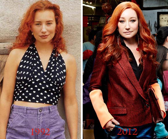 Tori Amos Plastic Surgery Before & After
