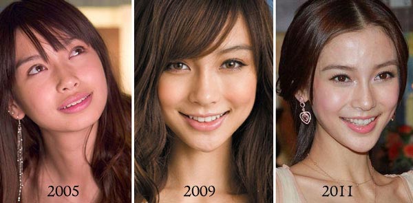 Angelababy Plastic Surgery Before & After