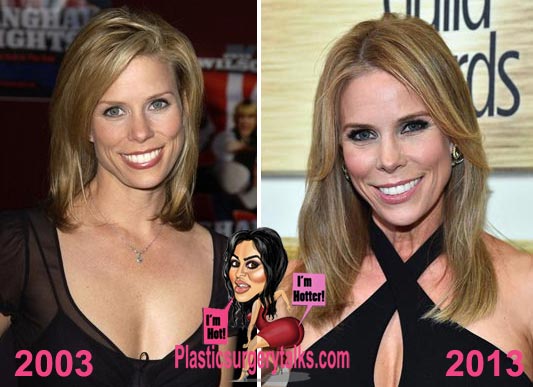 Cheryl Hines Plastic Surgery Before & After