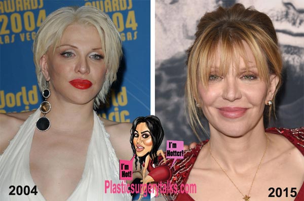 Courtney Love Plastic Surgery Before & After