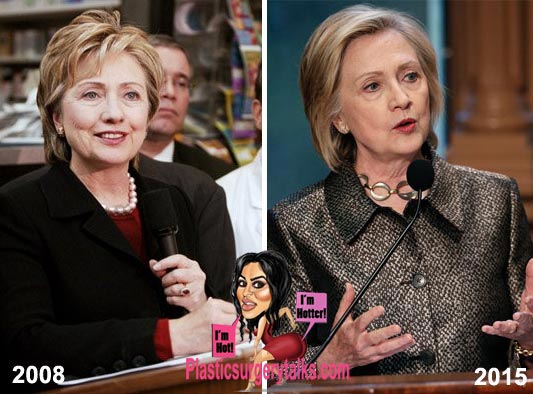 Hillary Clinton Facelift