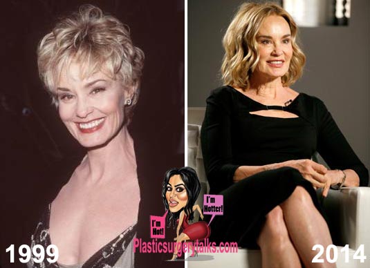 Jessica Lange Plastic Surgery Before & After