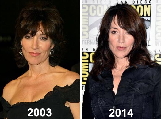 Katey Sagal Plastic Surgery Before & After