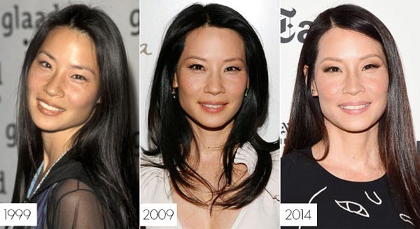 Lucy Liu Cosmetic Surgery