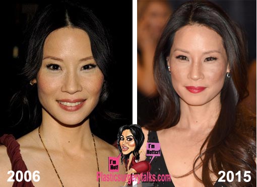 Lucy Liu Plastic Surgery Before & After