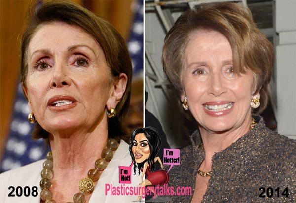 Nancy Pelosi Plastic Surgery Before & After
